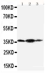 1 - Anti-Podoplanin/gp36 Antibody ABO10733