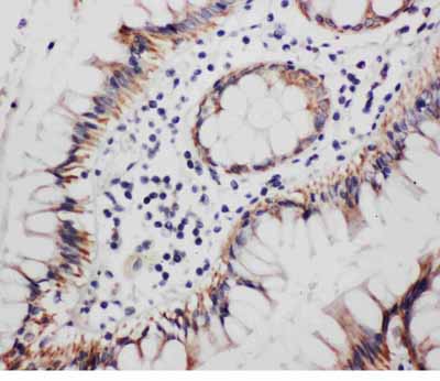 2 - Anti-Progesterone Receptor Antibody ABO10735