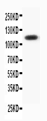 1 - Anti-Progesterone Receptor Antibody ABO10735