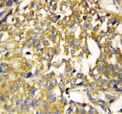 2 - Anti-Pleiotrophin Antibody ABO10736