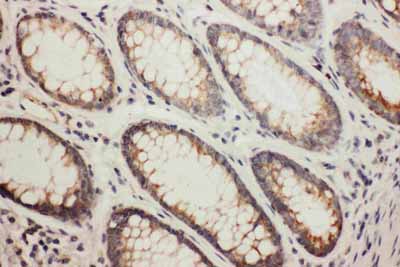 2 - Anti-NDRG1 Antibody ABO10738