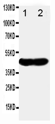 1 - Anti-NDRG1 Antibody ABO10738