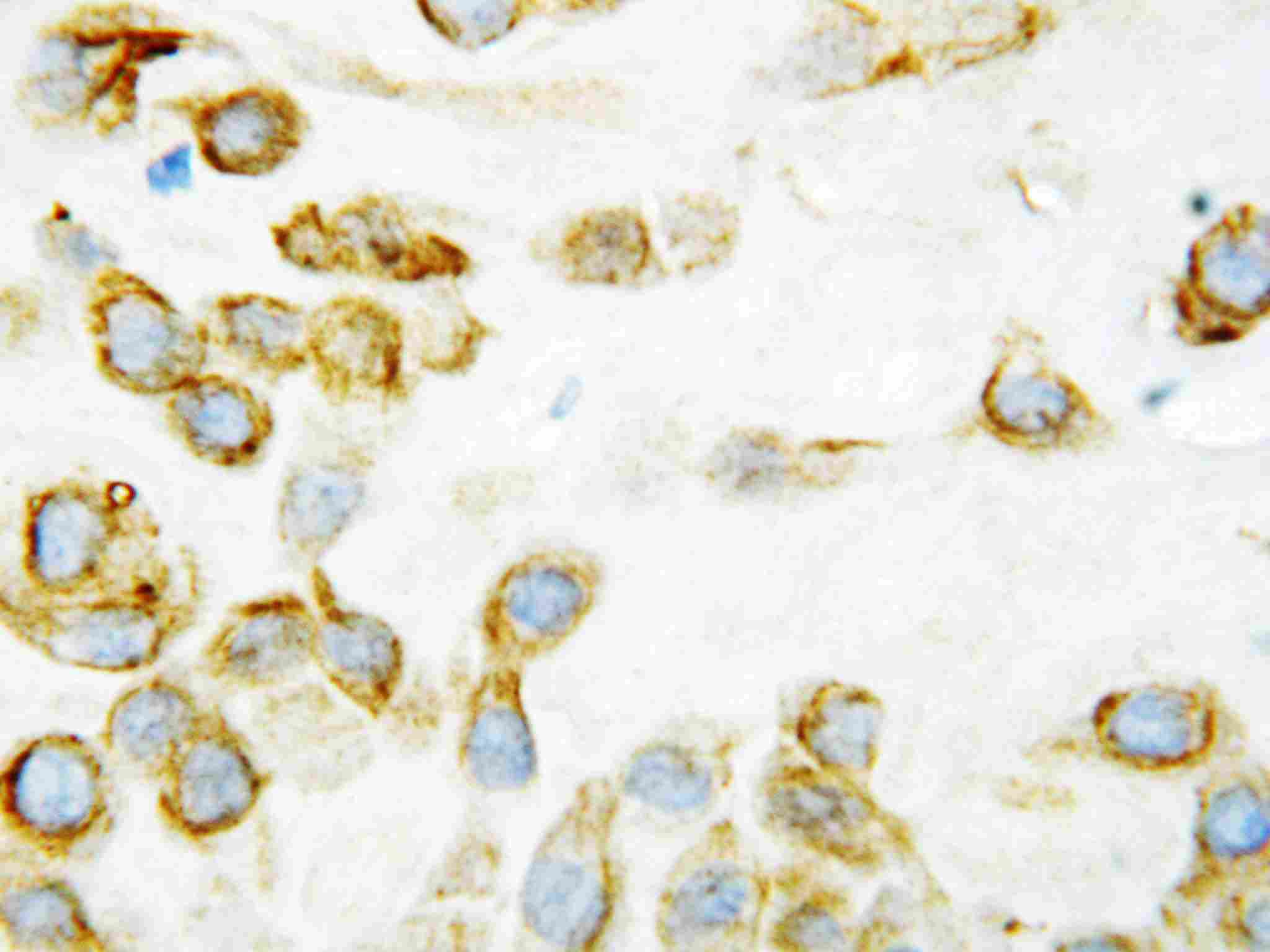 2 - Anti-TSP2 Antibody ABO10739