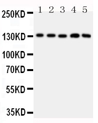 1 - Anti-TSP2 Antibody ABO10739