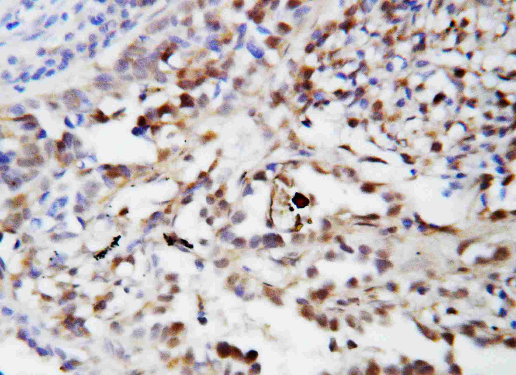 2 - Anti-Ubiquitin Antibody ABO10742