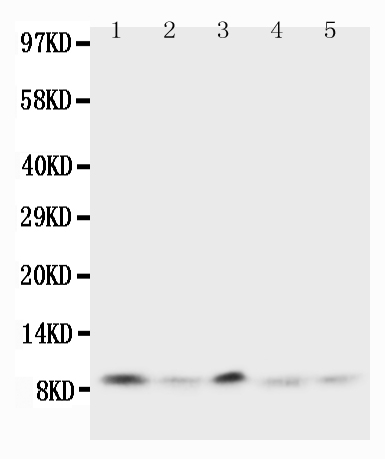 1 - Anti-Ubiquitin Antibody ABO10742