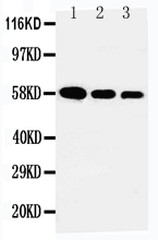 1 - Anti-Fetuin A Antibody ABO10743