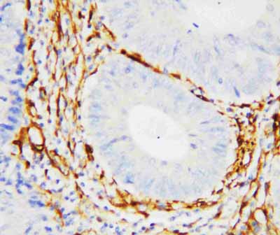 2 - Anti-Galectin-1 Antibody ABO10744