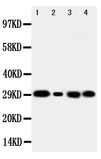 1 - Anti-Carbonic Anhydrase I Antibody ABO10747