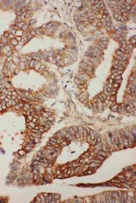 2 - Anti-BCL2L2 Antibody ABO10748