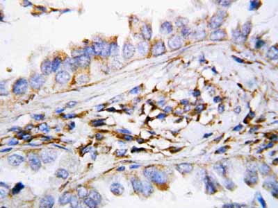 2 - Anti-CXCL9 Antibody ABO10751