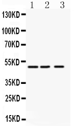 1 - Anti-ANGPTL4 Antibody ABO10755