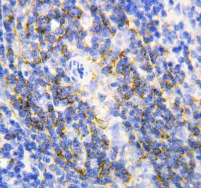 2 - Anti-Annexin VI Antibody ABO10756