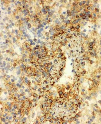 2 - Anti-Annexin VI Antibody ABO10756