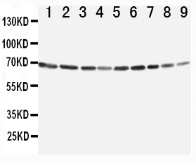 1 - Anti-Annexin VI Antibody ABO10756