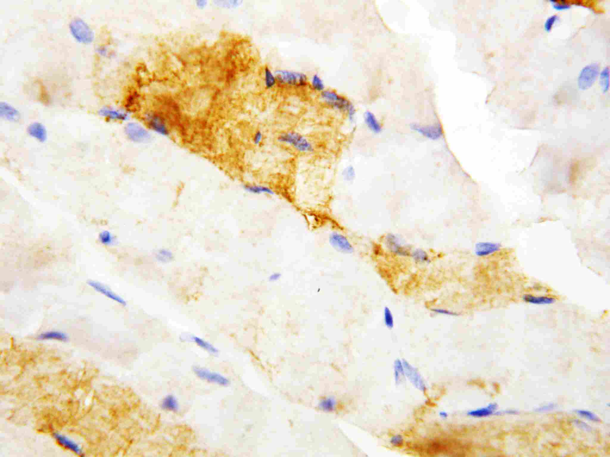 2 - Anti-CA3 Antibody ABO10758