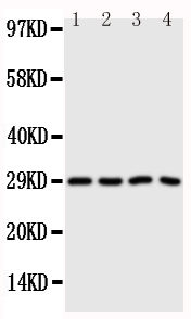 1 - Anti-CA3 Antibody ABO10758