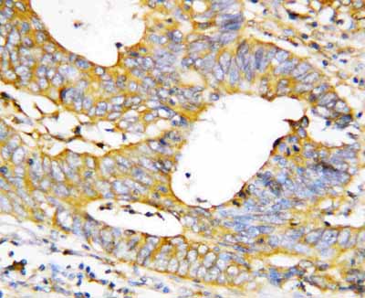 2 - Anti-Caspase-1(P20) Antibody ABO10759