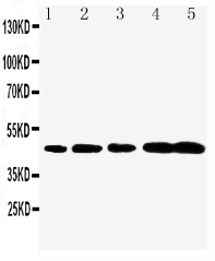 1 - Anti-Caspase-1(P20) Antibody ABO10760
