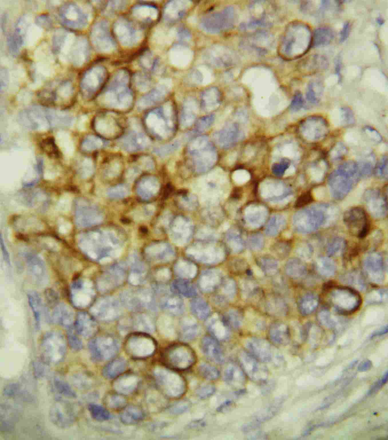 2 - Anti-Caspase-6(P18) Antibody ABO10761