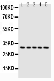 1 - Anti-Caspase-6(P18) Antibody ABO10761