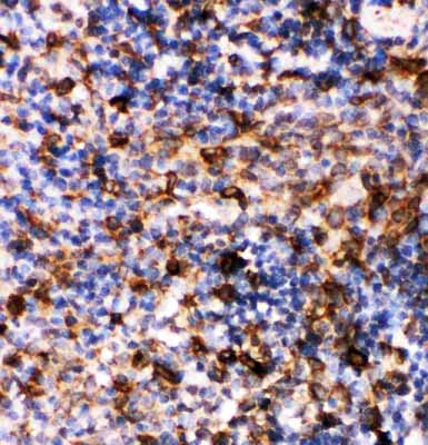 2 - Anti-Caspase-6(P18) Antibody ABO10762
