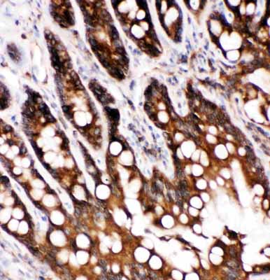2 - Anti-Caspase-6(P18) Antibody ABO10762
