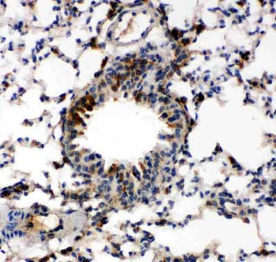 2 - Anti-Caspase-6(P18) Antibody ABO10762