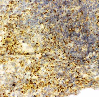 2 - Anti-Caspase-6(P18) Antibody ABO10762