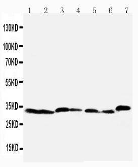 1 - Anti-Caspase-6(P18) Antibody ABO10762