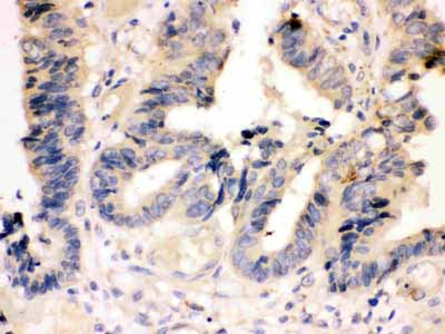 2 - Anti-Caspase-7(P11) Antibody ABO10763