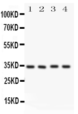 1 - Anti-Caspase-7(P11) Antibody ABO10763
