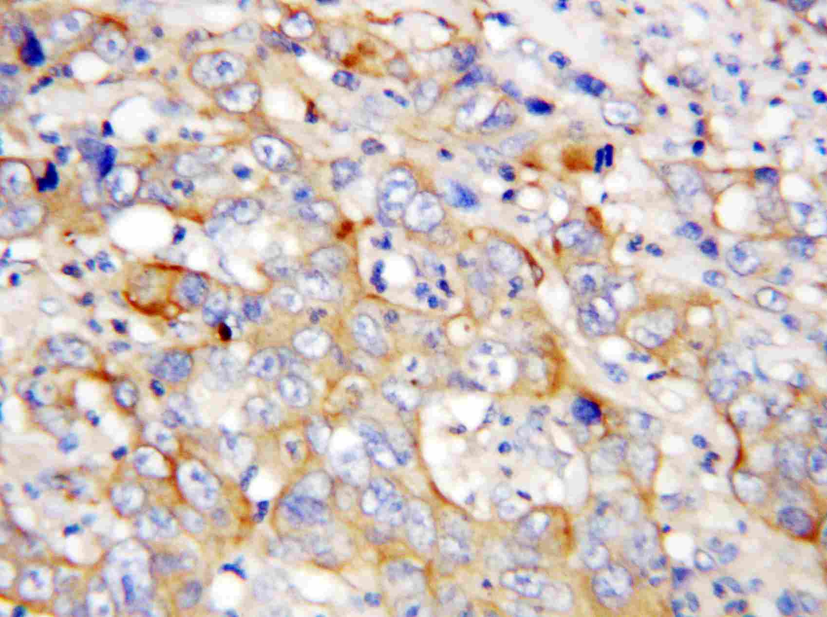 2 - Anti-PF4 Antibody ABO10767