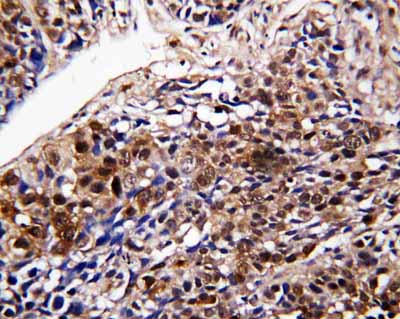 2 - Anti-DDT Antibody ABO10769
