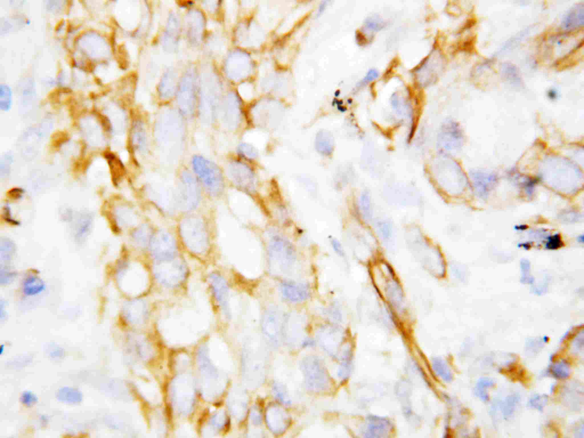 2 - Anti-Beta Defensin 1 Antibody ABO10770