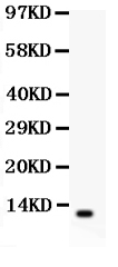 1 - Anti-Beta Defensin 1 Antibody ABO10770
