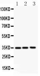 1 - Anti-GM-CSF Antibody ABO10776