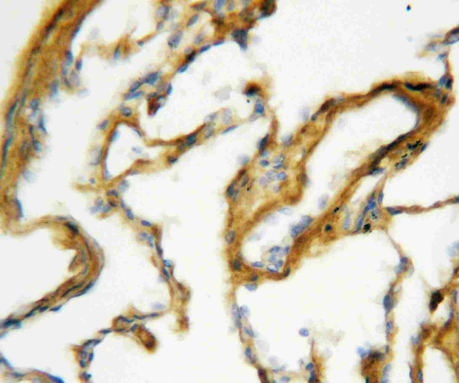 2 - Anti-SFTPA1 Antibody ABO10777