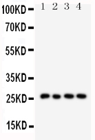 1 - Anti-SFTPA1 Antibody ABO10777