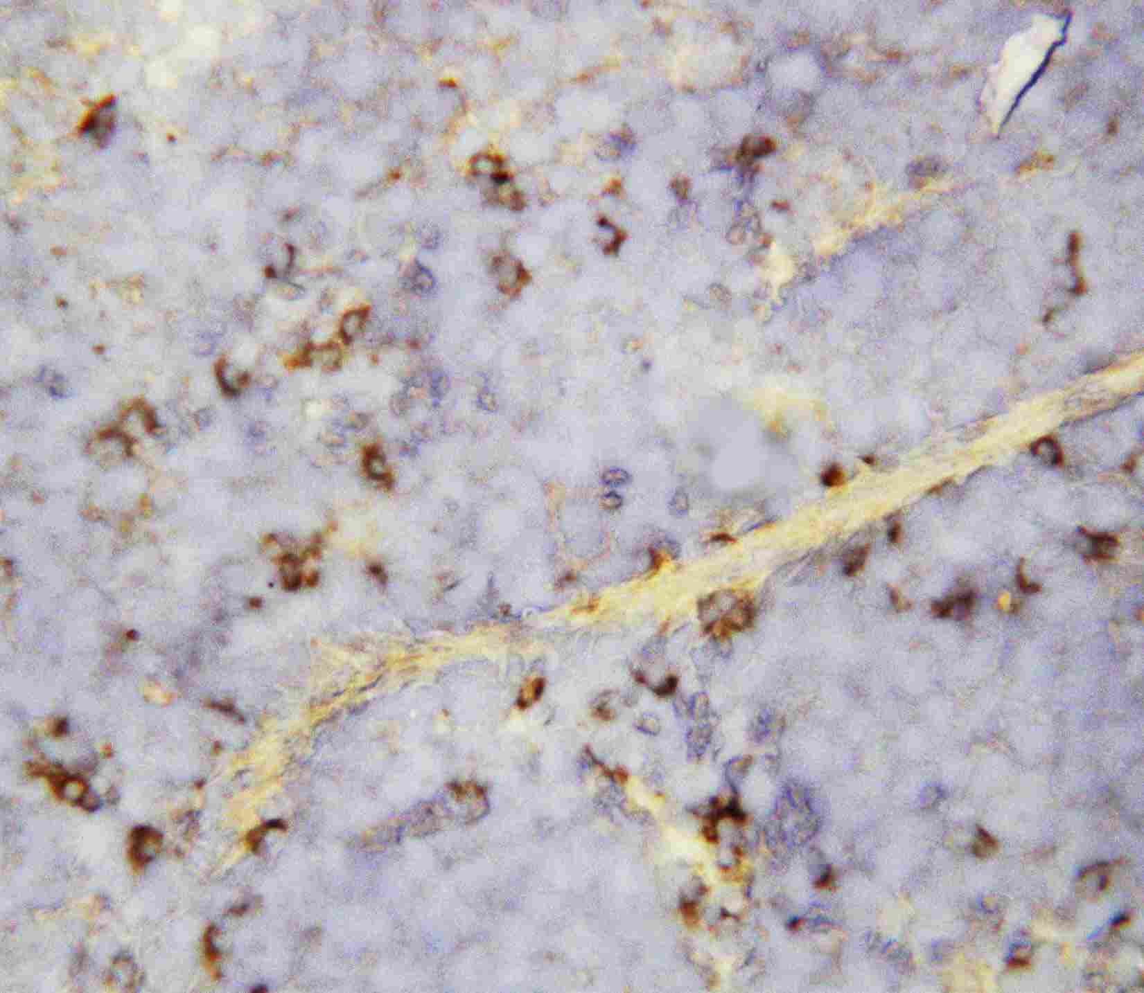 2 - Anti-CXCL16 Antibody ABO10779