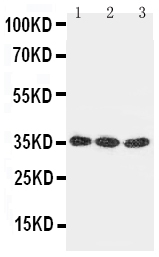1 - Anti-DKK-1 Antibody ABO10781