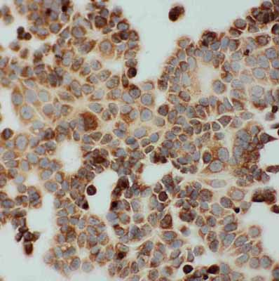 8 - Anti-DLD Antibody ABO10782