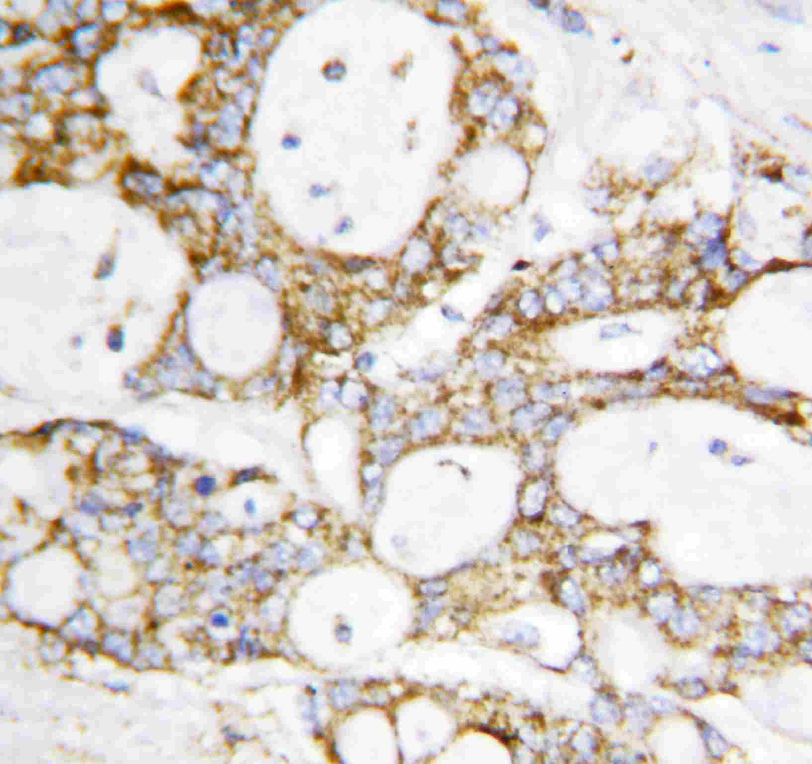 2 - Anti-DLD Antibody ABO10782
