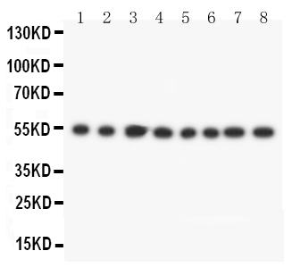 1 - Anti-DLD Antibody ABO10782