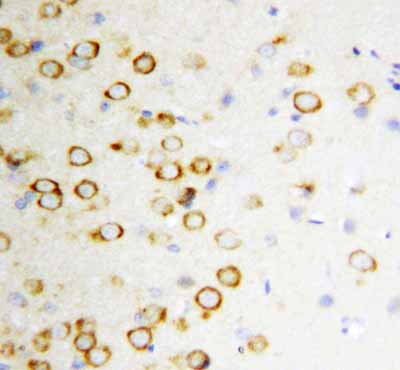 2 - Anti-GDNF Antibody ABO10784