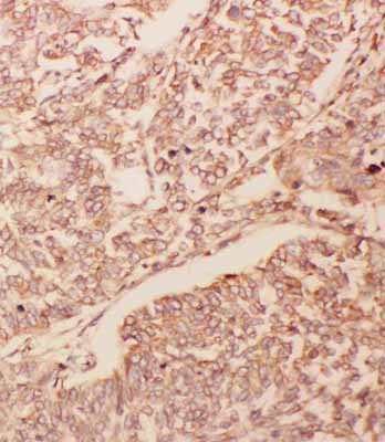 2 - Anti-GDNF Antibody ABO10784