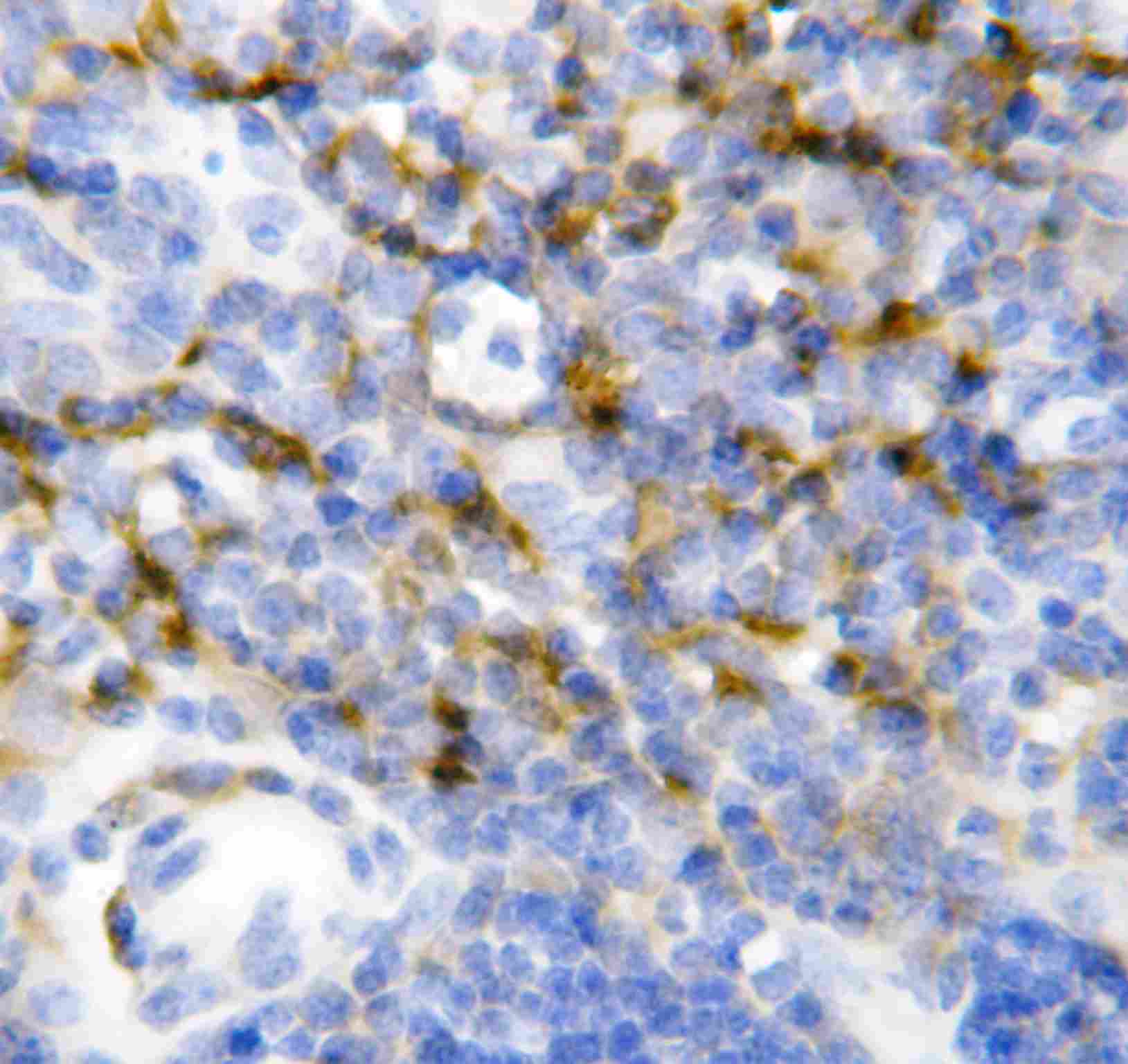 2 - Anti-IL-7 Antibody ABO10786