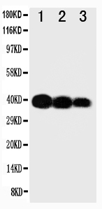 1 - Anti-IL-12(p40) Antibody ABO10787
