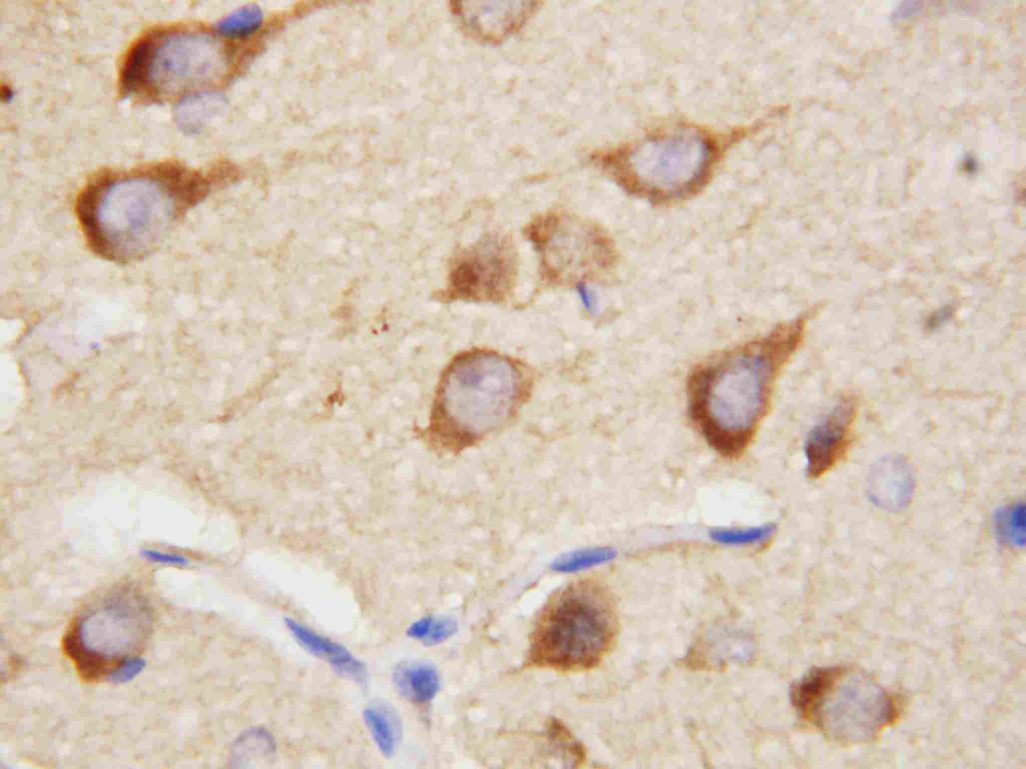 2 - Anti-PPID Antibody ABO10791