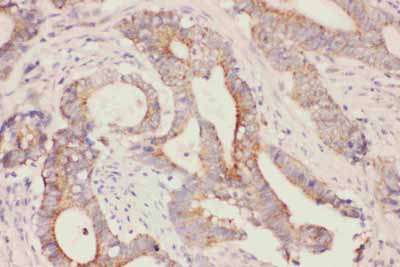 2 - Anti-Fatty Acid Binding Protein 5 Antibody ABO10794